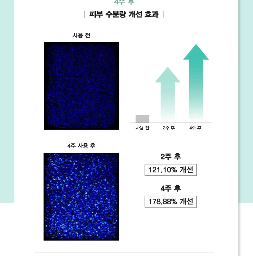 [오리지널 PDRN 부스팅]리쥬란 리커버 힐러 부스팅 젤 200ml 상세페이지 18